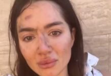Упала со склона, убегая от извращенца: в Одессе девушку пытался изнасиловать незнакомец